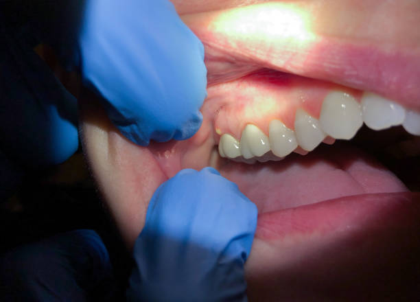 Best Walk-In Emergency Dental Services in Byhalia, MS