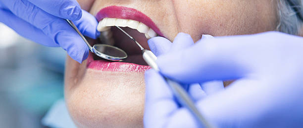 Best Lost Filling or Crown Replacement in Byhalia, MS